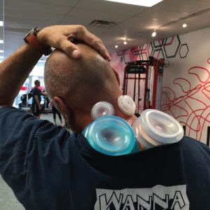 Cupping therapy helps relieve pain